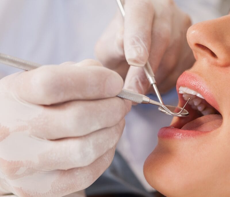 Los guantes de nitrilo para dentista destacan por su alta resistencia frente a agentes químicos